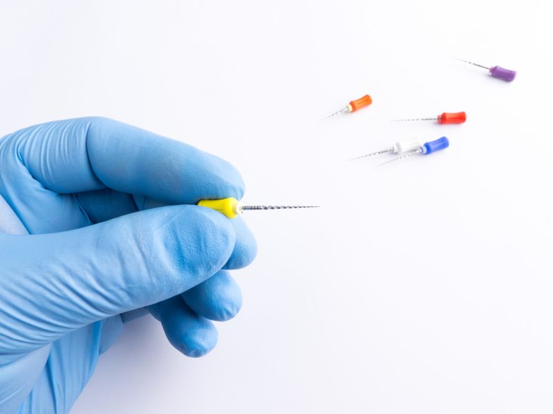 Endodoncia o tratamiento de conducto para conservar el diente natural