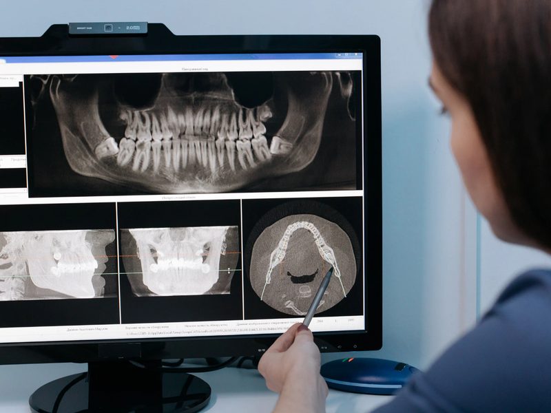 Informe radiológico elaborado por especialista en radiología oral y maxilofacial