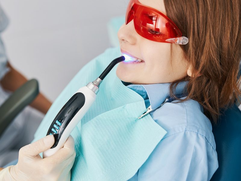 Resinas dentales del color del diente para reparar caries o fracturas